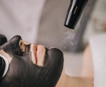 carbon Peel